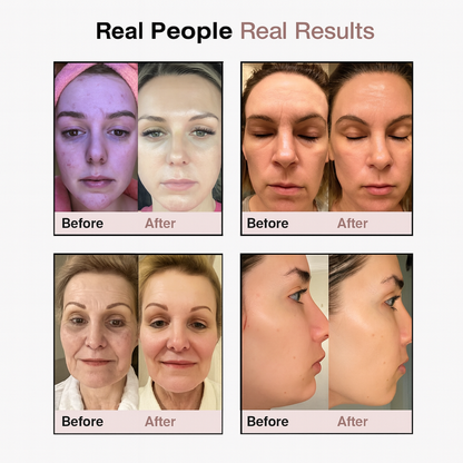 Soloria LED Face & Neck Lifter